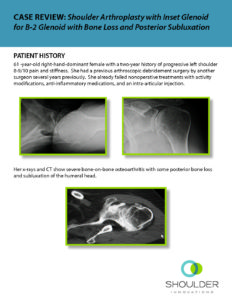 Shoulder Innovations