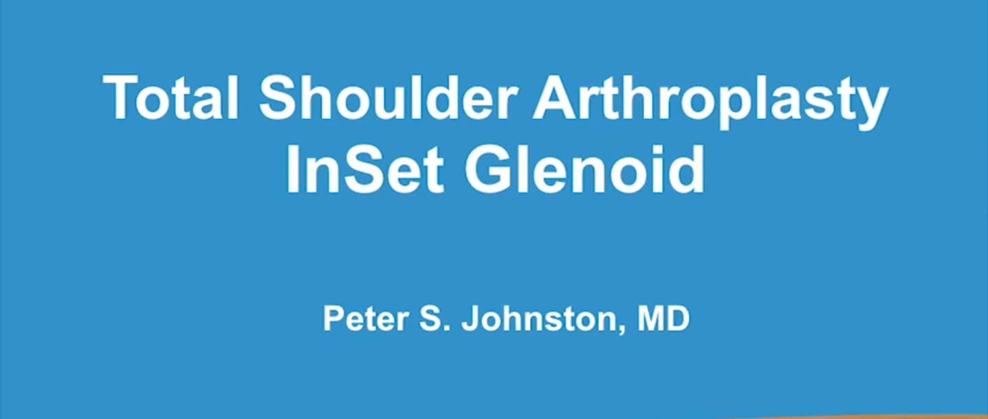 InSet™ Glenoid Technique Video From Dr. Peter Johnston