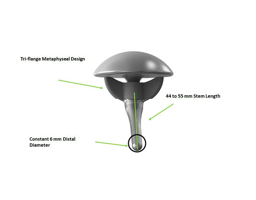 inset humeral stem