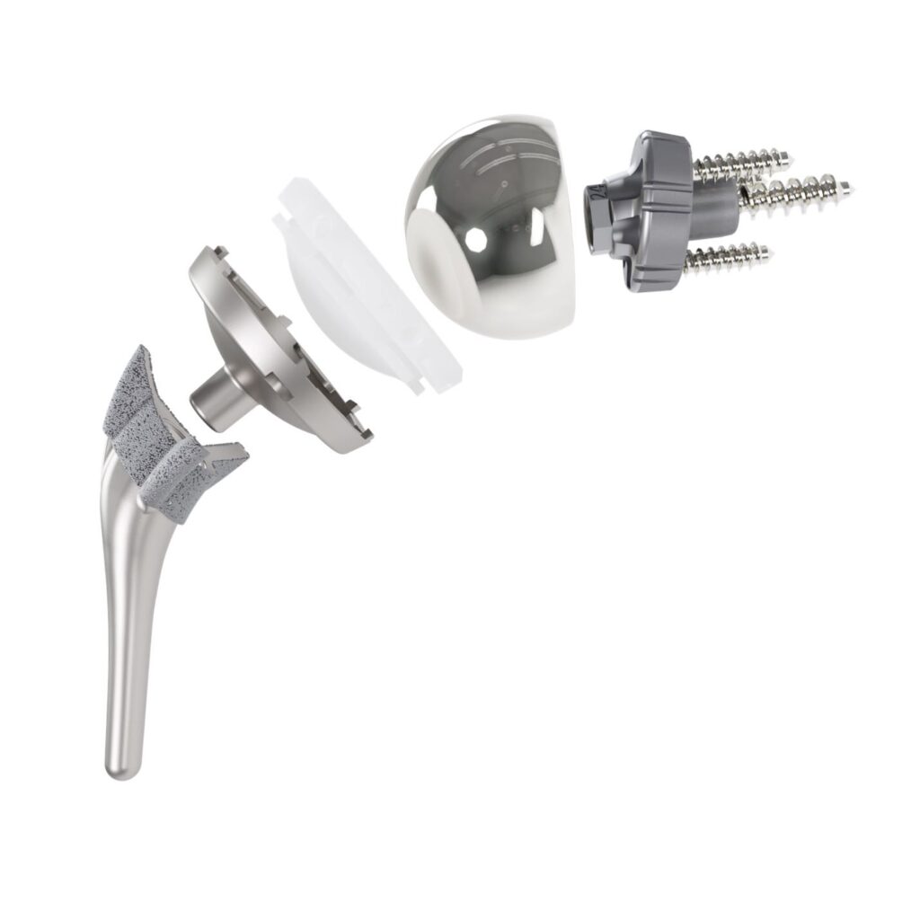 Reverse shoulder implant components from the InSet™ system