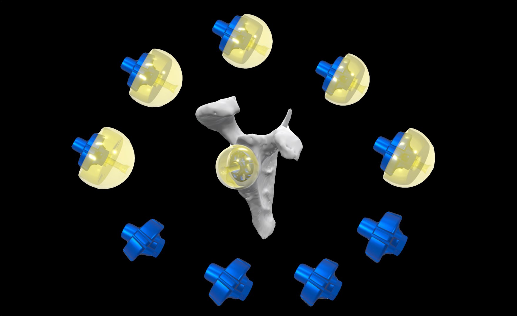 Multiple glenoid configurations are available with the InSet™ reverse shoulder implant