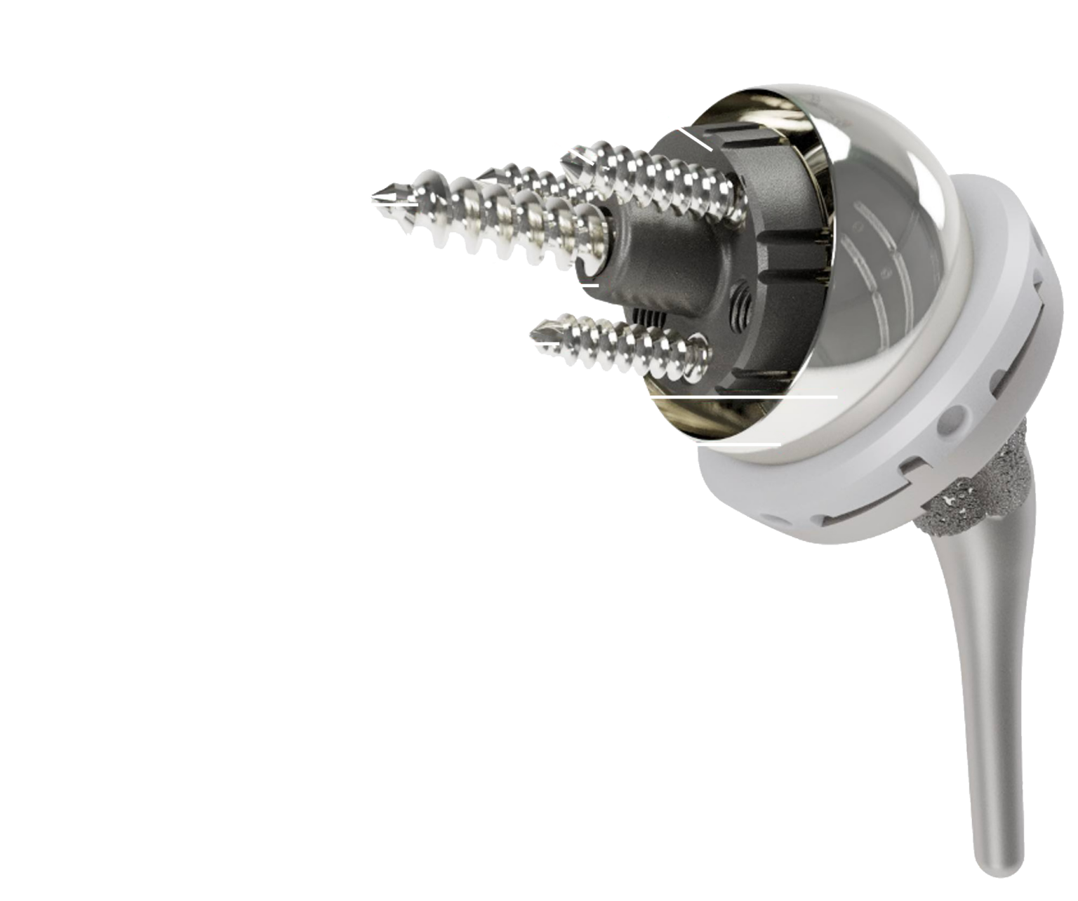 InSet™ Reverse Total Shoulder System Shoulder Innovations