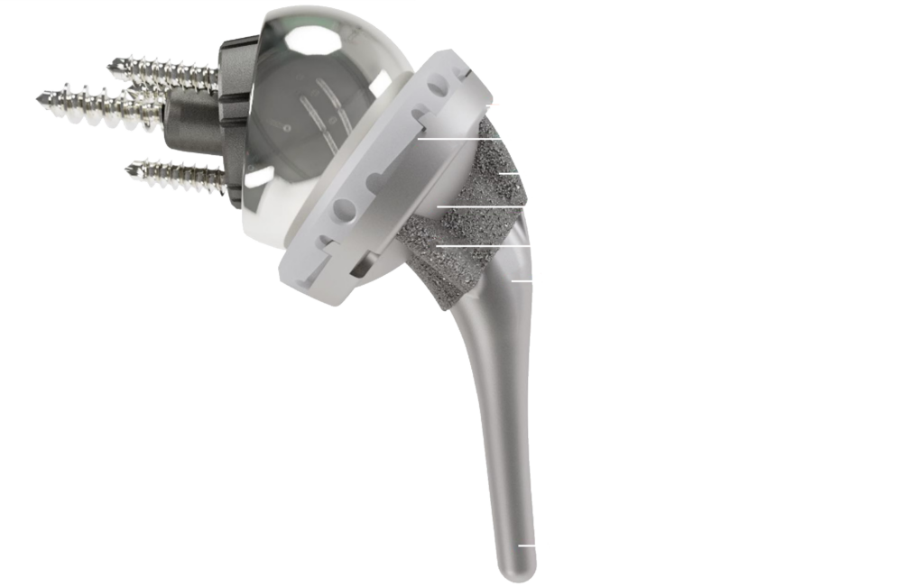 InSet™ Reverse Total Shoulder System Shoulder Innovations